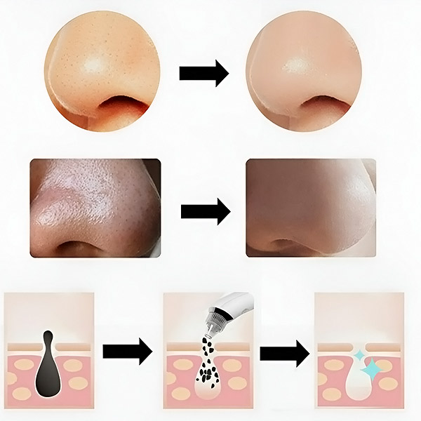 KILPOR specifikationer